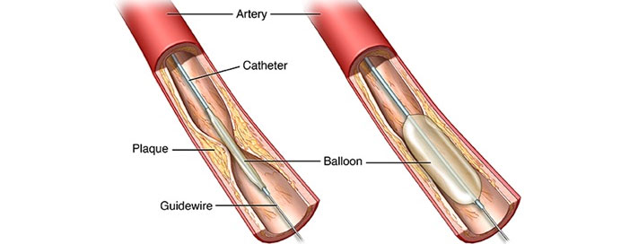 Best Consultant Interventional Cardiologist In Kandivali